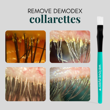 Load image into Gallery viewer, Product for removing Demodex collarettes with close-up images of eye lashes and a teal tool labeled 'we love eyes'.
