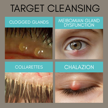 Load image into Gallery viewer, Eye health issues with text labels on a brown background