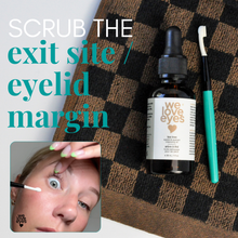Load image into Gallery viewer, Bottle of 'we love eyes' product with a dropper on a checkered towel.
