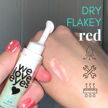 Load image into Gallery viewer, Hand applying eyelid butter to eyelid with text 'Dry Flakey red' and icons.