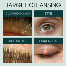 Load image into Gallery viewer, Educational diagram showing different eye issues with labeled images and text.
