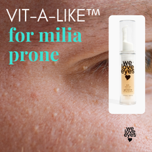 Load image into Gallery viewer, Product for milia prone skin with 'we love eyes' branding on a close-up of skin with blemishes.