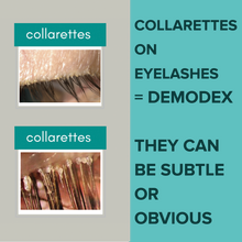 Load image into Gallery viewer, Demodex Mites Debris Cleansing System (+ free cosmetic bag)