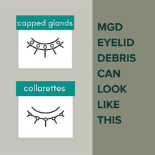 Load image into Gallery viewer, Posterior Blepharitis MGD Cleansing System