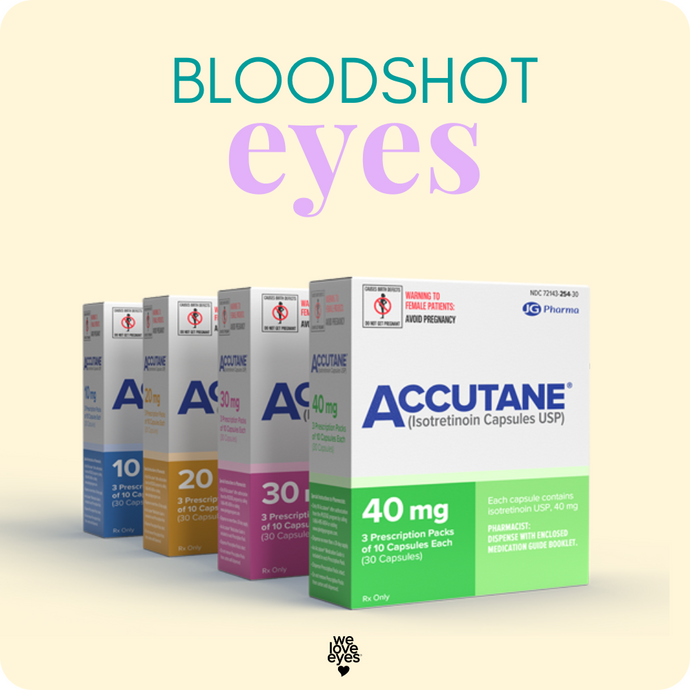Managing BLOODSHOT EYES on ACCUTANE: Causes, Tips, and When to See an Optometrist