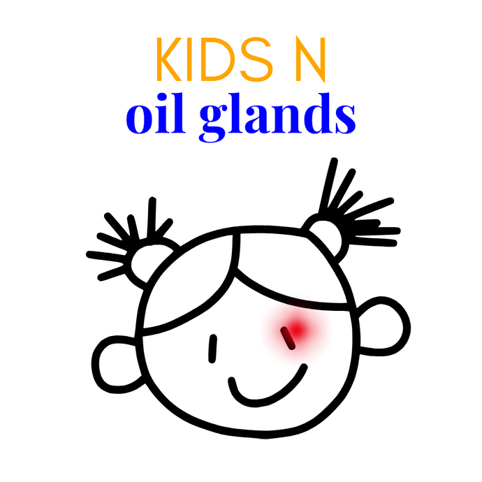 Understanding Why Kids Are Prone to Chronic Chalazia / Chalazion: Prevention & Treatment Tips by Dr. Tanya Gill, OD