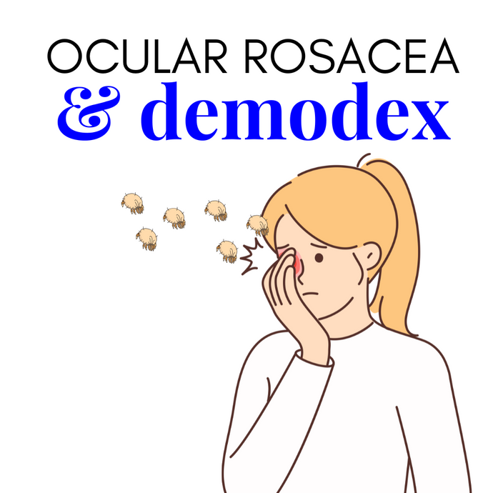 How Ocular Rosacea and Demodex Mites Are Connected: Key Insights for Optimal Eye Health