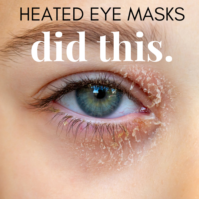 PM Eyelid Butter: Relieve Dry, Red, and Flaky Eyelids Caused by Heated Eye Masks