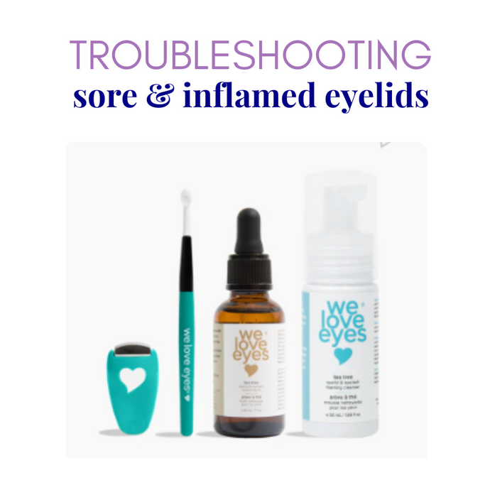 Effective Chalazion Management: Expert Eye Care Tips from Dr. Tanya Gill, OD