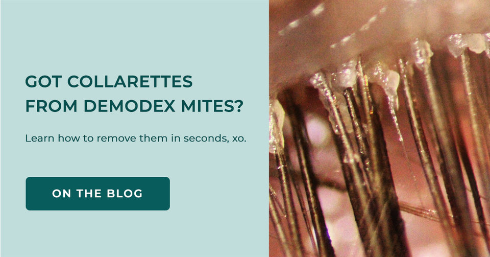 Got Collarettes from Demodex mites? Learn how to remove them in seconds.