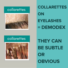 Load image into Gallery viewer, Demodex Mites Debris Cleansing System + bonus travel pouch
