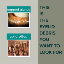 Load image into Gallery viewer, Stye Cleansing System

